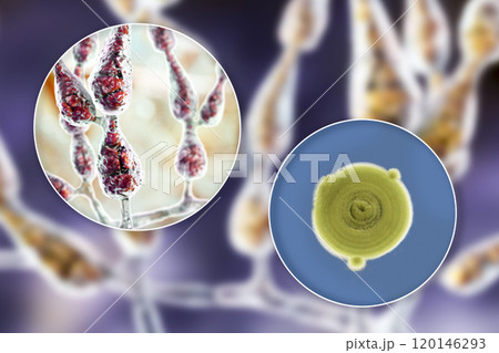 Mold Alternaria alternata, illustration and photo of colony on nutrient medium Mold Alternaria alternata, illustration and photo of colony on nutrient medium 120146293