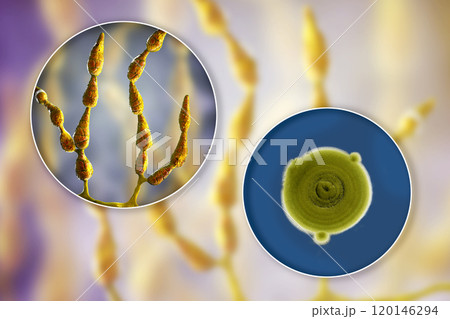 Mold Alternaria alternata, illustration and photo of colony on nutrient medium 120146294