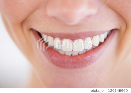 Dazzling smile. Close up of a womans sparkling teeth. Dazzling smile. Close up of a womans sparkling teeth. 120146960