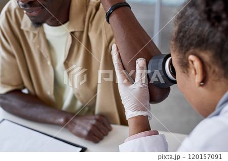 Detail shot of dermatologist examining skin using dermascope during patient check up in clinic copy space 120157091