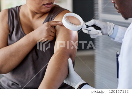 Close up of dermatologist examining female patient using magnifying glass during consultation in clinic 120157132