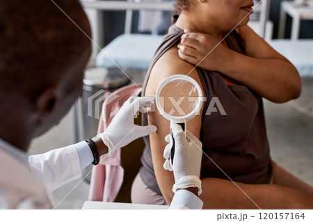 Over shoulder view of dermatologist examining suspicious mole with magnifying glass while consulting female patient in clinic Over shoulder view of dermatologist examining suspicious mole with magnifying glass while consulting female patient in clinic 120157164