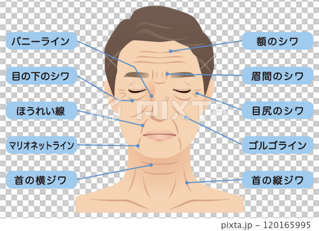 中年男性　シワ　名称　美容　老化 120165995
