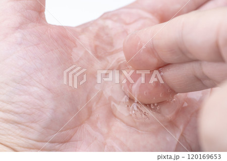 手のひらにのせた透明なジェルのクローズアップ 手のひらにのせた透明なジェルのクローズアップ 120169653