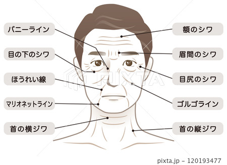中年男性　シワ　名称　美容　老化 120193477