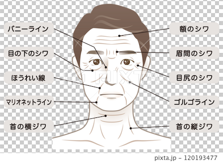 中年男性　シワ　名称　美容　老化 120193477