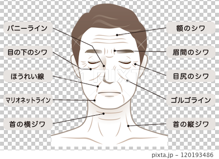 中年男性　シワ　名称　美容　老化 120193486