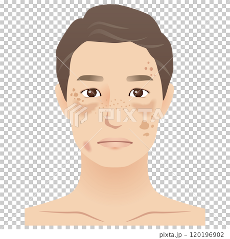 中年男人,污漬,美容,衰老 中年男人,污漬,美容,衰老 120196902