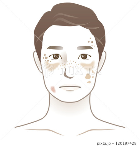 中年の男性 シミ 美容 老化 中年の男性 シミ 美容 老化 120197429