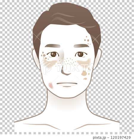 中年の男性 シミ 美容 老化 中年の男性 シミ 美容 老化 120197429