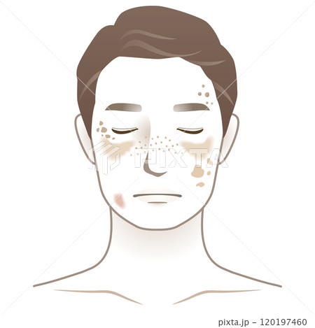 中年の男性 シミ 美容 老化 中年の男性 シミ 美容 老化 120197460