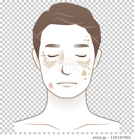 中年の男性 シミ 美容 老化 中年の男性 シミ 美容 老化 120197460