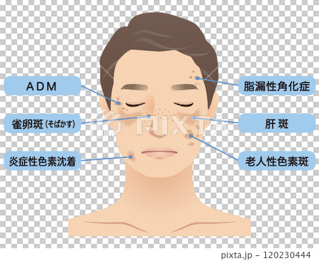 中年男子污點名美衰老 120230444