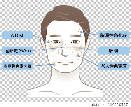 中年男性　シミ　名称　美容　老化 120230537