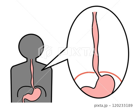正常な食道　横隔膜 120233189