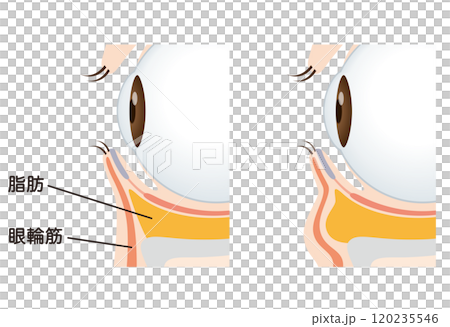 目の下のたるみ　たるみのない目元と、たるんだ目元 120235546