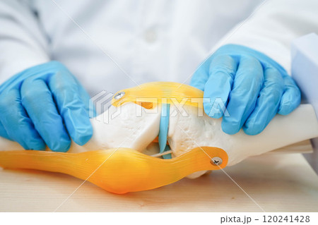 Knee osteoarthritis, Doctor showing model knee joint orthopedic. 120241428