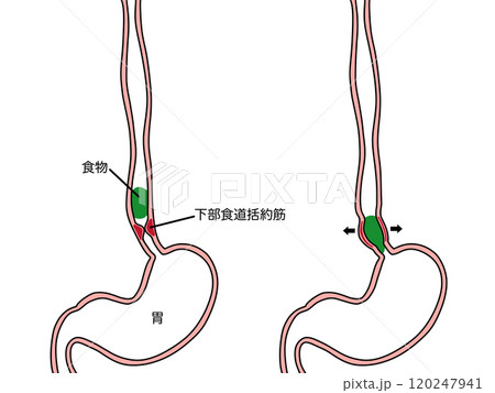 下部食道括約筋と食物　文字あり 120247941