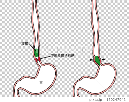 下部食道括約筋と食物　文字あり 120247941