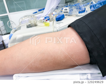 Blood platelet donation, a male nurse inserts a needle into donor arm to draw blood at a hospital. 120249629