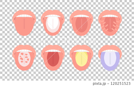 舌頭健康狀態類型插圖集 120251523