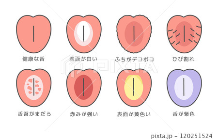 舌の健康状態 種類 イラストセット(説明あり) 舌の健康状態 種類 イラストセット(説明あり) 120251524