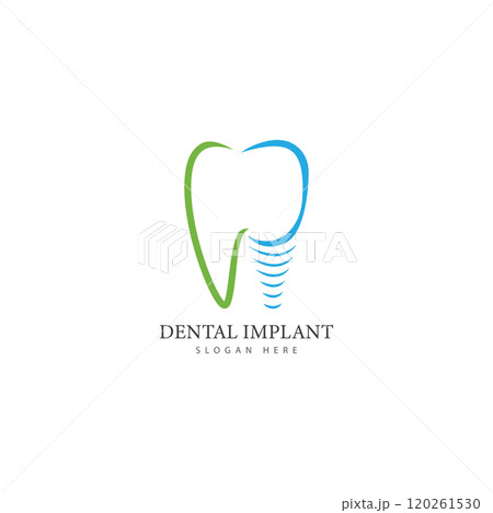 dental implant logo design concept vector dental care logo template dental implant logo design concept vector dental care logo template 120261530