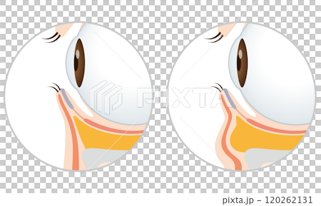 Sagging under the eyes: Firm eyes and sagging eyes 120262131