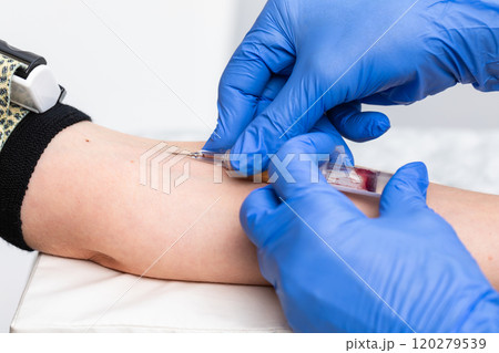 Blood Sample Collection by Medical Professional 120279539