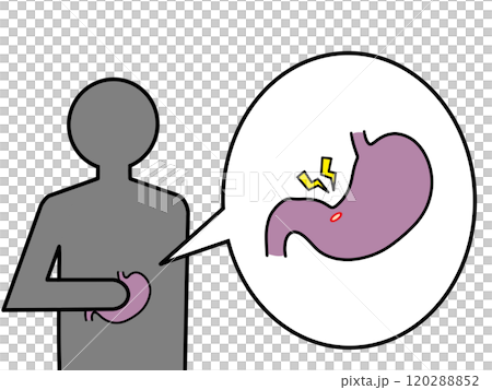 胃潰瘍による胃痛 胃潰瘍による胃痛 120288852