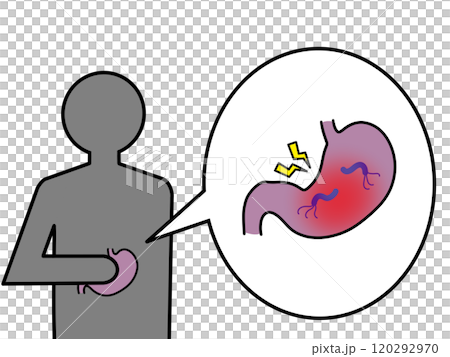 Helicobacter pylori-induced gastritis 120292970