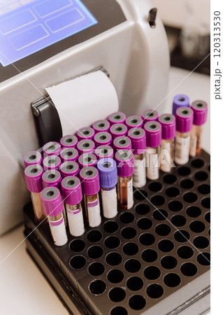 Close up of blood sample tubes in a lab rack, ready for analysis and diagnostics Close up of blood sample tubes in a lab rack, ready for analysis and diagnostics 120313530