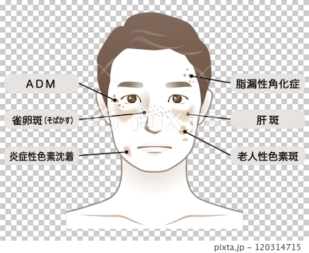 Middle-aged men, age spots, name, beauty, aging 120314715