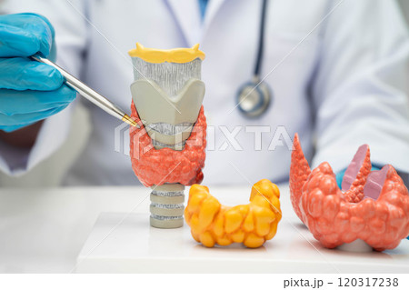 Hyperthyroidism, Overactive Thyroid, Thyroid Lymphoma, Asian doctor with thyroid gland human anatomy model in hospital. Hyperthyroidism, Overactive Thyroid, Thyroid Lymphoma, Asian doctor with thyroid gland human anatomy model in hospital. 120317238