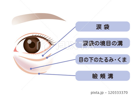 目の下のたるみ　たるんだ下まぶた 120333370
