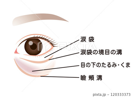 目の下のたるみ　たるんだ下まぶた 120333373