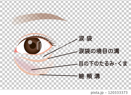 目の下のたるみ　たるんだ下まぶた 120333373