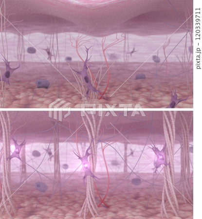3D Illustration of Youthful vs. Aging Skin: Before and After Skin Rejuvenation with Collagen and Elastin 3D Illustration of Youthful vs. Aging Skin: Before and After Skin Rejuvenation with Collagen and Elastin 120339711