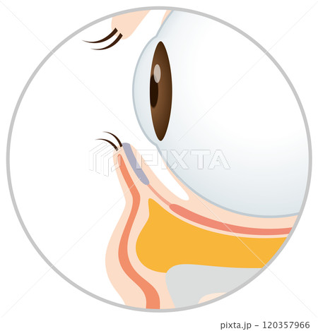 目の下のたるみ たるんだ下まぶた 目の下のたるみ たるんだ下まぶた 120357966