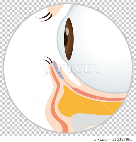 目の下のたるみ たるんだ下まぶた 目の下のたるみ たるんだ下まぶた 120357966