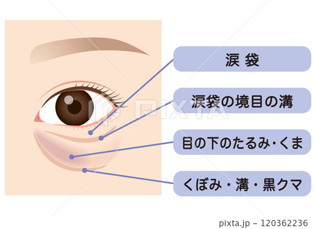 目の下のたるみ　たるんだ下まぶた 120362236