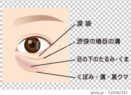 目の下のたるみ　たるんだ下まぶた 120362261