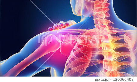 肩関節の視覚表現: ルンバー領域での痛みと不快感を具現化したイメージ. 120366408