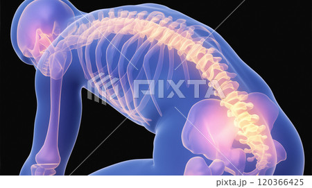 腰痛の視覚表現: ルンバー領域での痛みと不快感を具現化したイメージ. 120366425