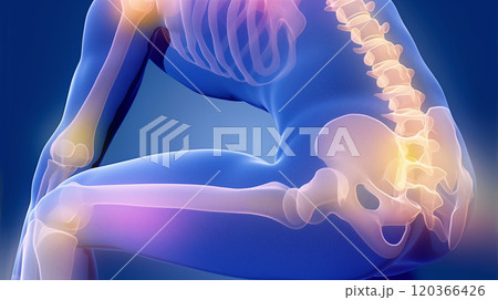 腰痛の視覚表現: ルンバー領域での痛みと不快感を具現化したイメージ. 120366426