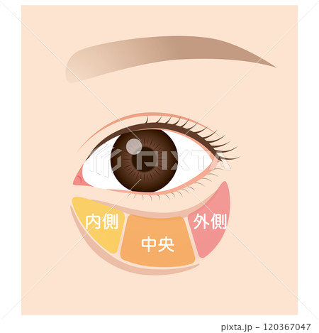眼窩脂肪 目の下のたるみ たるんだ下まぶた 眼窩脂肪 目の下のたるみ たるんだ下まぶた 120367047