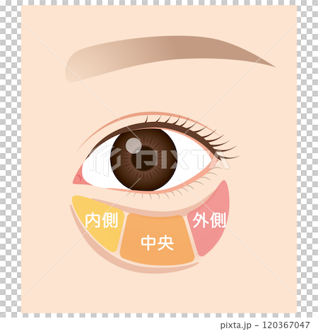 眼眶脂肪、眼袋、下眼瞼下垂 眼眶脂肪、眼袋、下眼瞼下垂 120367047