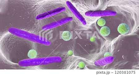 Bacteria inside dental cavity 120381075