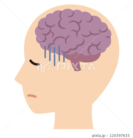 脳のストレス 疲労 脳のストレス 疲労 120397633