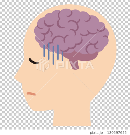 脳のストレス 疲労 脳のストレス 疲労 120397633